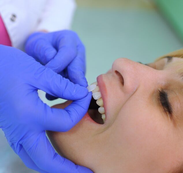 Woman having a shade guide held to her tooth by cosmetic dentist in Springfield
