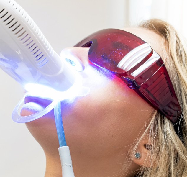 Woman undergoing teeth whitening (Which Cosmetic Dental Service is Right for Me?